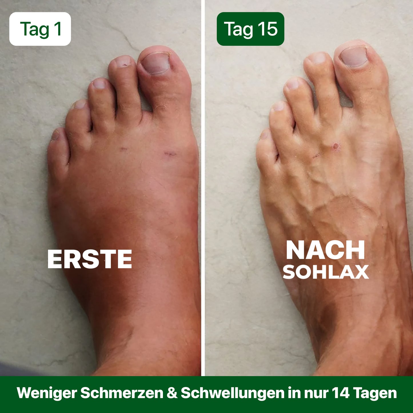 Sohlax - Schluss mit Fußschmerzen
